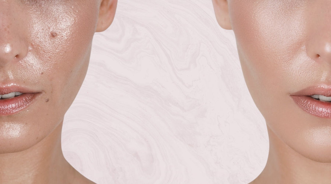 vasemmalla puolella rasvoittunut ja oikealla puolella rasvoittumaton iho vaaleanpunaista taustaa vasten